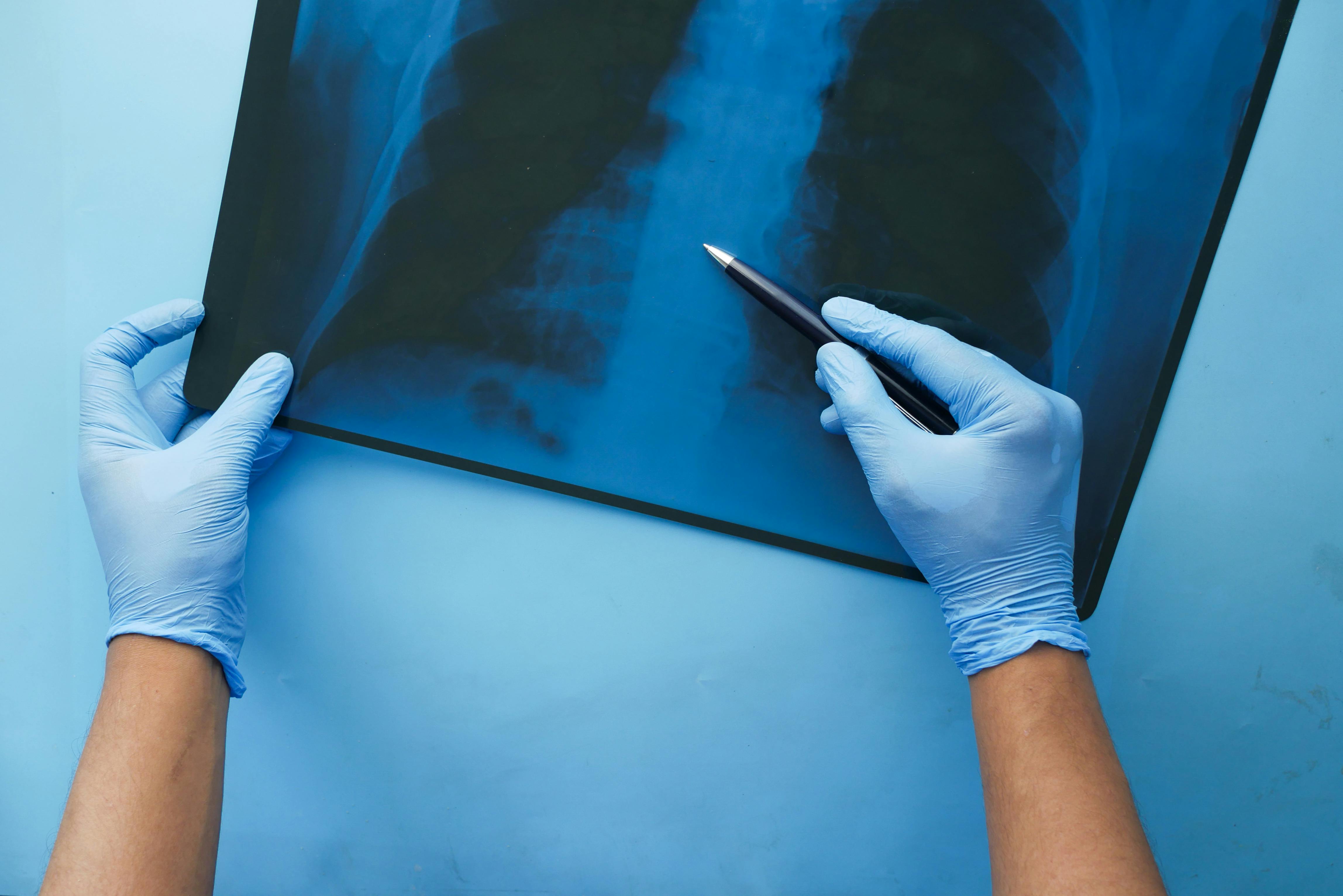 AI in Medical Imaging: The Future of Disease Diagnosis